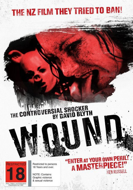 Wound (2010) Brrip Xvid Ac3-Anarchy